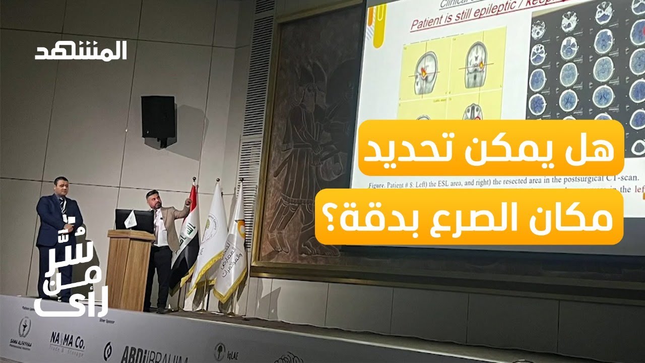 عراقي يجد علاجا للصرع! - سُّر من رأى
