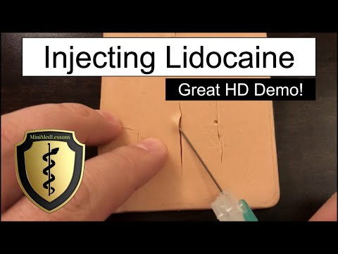 Injecting Lidocaine for a Laceration - HD Video Demonstration!