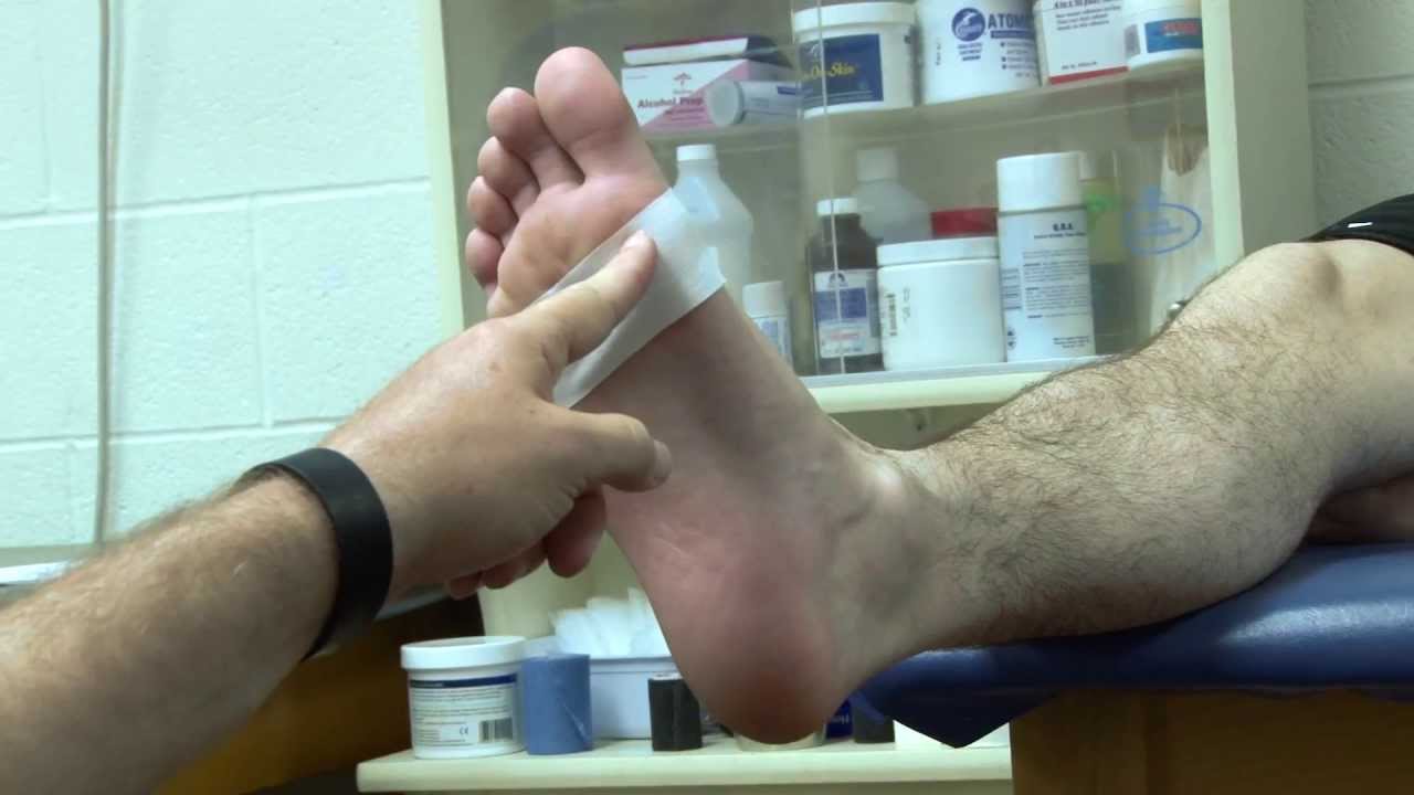 Longitudinal Arch Taping