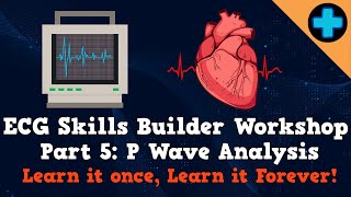 Electrocardiogram (ECG) Skills Builder Workshop Part 5: P Wave Analysis