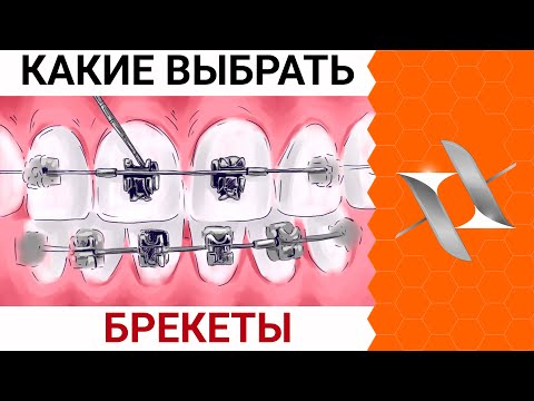 Какие ВЫБРАТЬ БРЕКЕТЫ в 2022 | Лигатурные vs самолигирующиеся