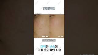 색소 치료 명가 타토아의원 신사점의 대표 관리 #연예인필