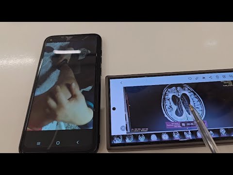 Gaymoritdan Keyingi Koma Holati 