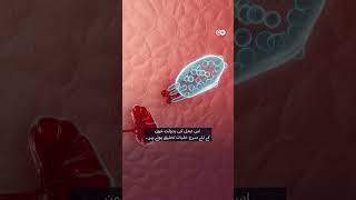 تلی، مدافعتی نظام کا اہم جزو کیوں؟ Importance of Spleen. #spleen #tilli #dwurdu #infoshorts #health