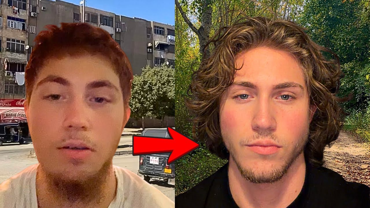 Mon voyage en Égypte a détruit mon visage