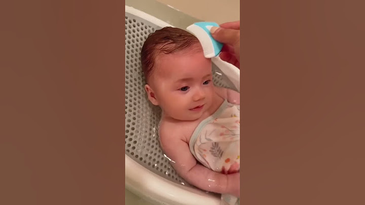 MOM HACK for cradle cap! Mom tips/tricks. Mom Hacks/Parenting Hack/Baby/Baby Hacks/Baby Products