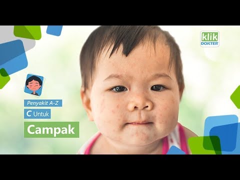 Video: Toksokariasis Pada Anak-anak - Penyebab, Gejala Dan Pengobatan
