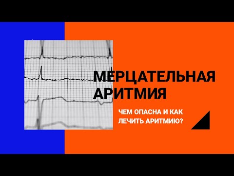 МЕРЦАТЕЛЬНАЯ АРИТМИЯ.  Как лечить и чем опасна? фибриляцияпредсердий#кардиолог#инсульт#антикоагулянт