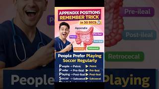 Appendix Positions in 30 Sec 🧠🔥 | NEET PG Trick #shorts #biology #medico #anatomy #neetpg #mbbs