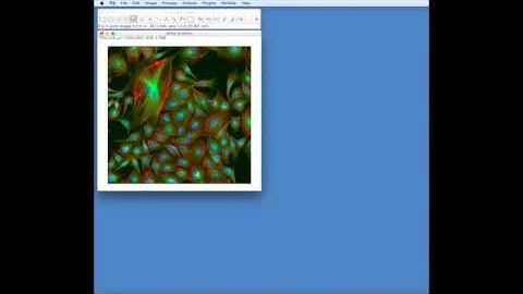 FIJI: Adding a scale bar