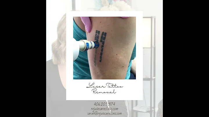 Sarah Konen, Certified Laser Technician