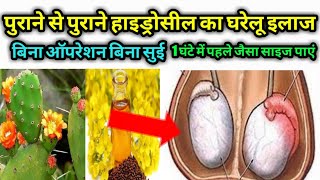 हाइड्रोसील का अचूक इलाज.Hydrocele Ka Gharelu ilaj.Hydrocele Ka Ayurvedic Ilaaj,RK Nishad Ayurvedic