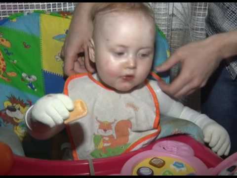 Девочка-бабочка. Сюжет о Софии Вербинской. Программа "Вести Нерюнгринский район" Девочка-бабочка. Сюжет о Софии Вербинской. Программа "Вести Нерюнгринский район"