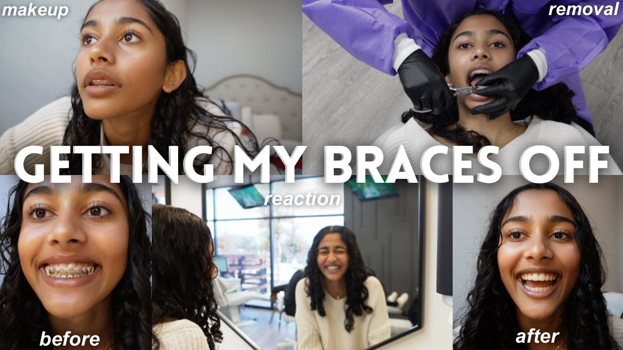 GETTING MY BRACES OFF *after 2 years* | makeup, braces removal, + reaction! ♡ | 12 days of Vlogmas