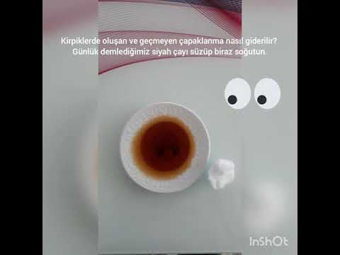 Kirpiklerdeki gözlerdeki çapaklanma