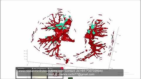 Implementation of 3D Lungs segmentation in Matlab| +91-8283824812  for any related query