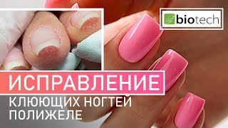 КАК ИСПРАВИТЬ КЛЮЮЩИЕ НОГТИ?