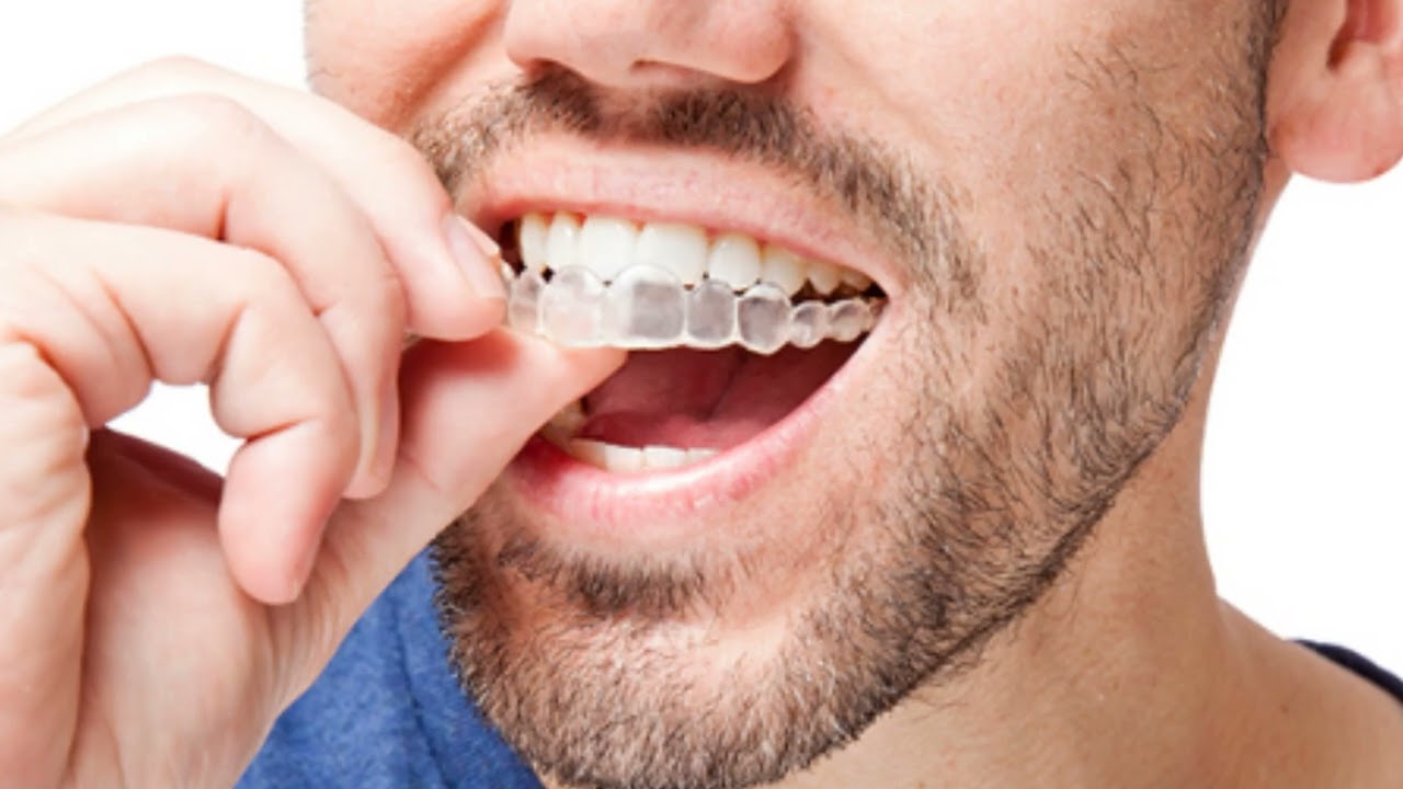 Dentist Miami Springs FL | Apple Dental Group
