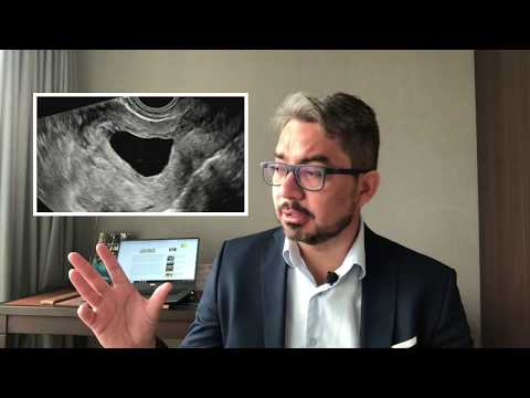 Vídeo: Em um saco embrionário fertilizado?