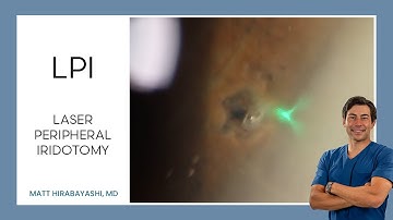 LPI (Laser Peripheral Iridotomy)