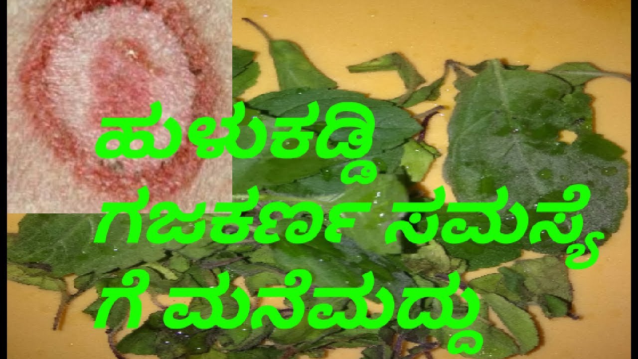 100 working Remedy For Hulukaddi And 100-working-remedy-for-hulukaddi-and
