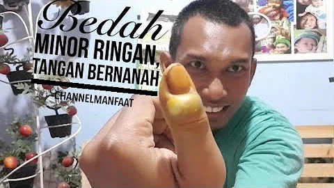 Bedah minor Sendiri, Tangan Infeksi, Tangan menggembung , Bernanah ...