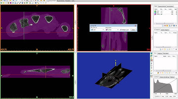 Learn how to crop, cavity fill and regiongrow in MIMICS 13