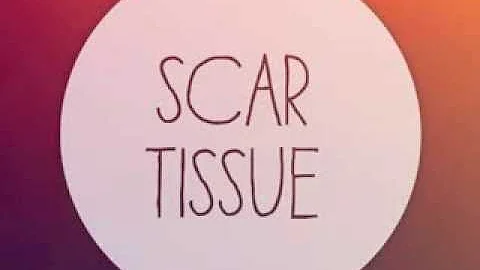 NTO - Scar Tissue