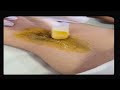 Underarms waxing in beauty parlour Frist time