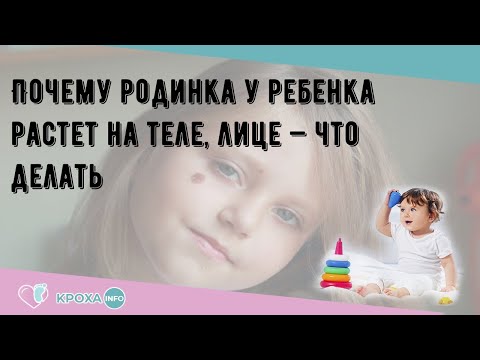 Почему родинка у ребенка растет на теле, лице — что делать