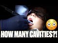 TAKING FOUR KIDS TO THE DENTIST | FINDING 11 CAVITIES 😳 WHICH KID NEEDS BRACES? KIDS GETTING BRACES