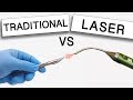 What's Best for Gum Disease Treatment? Surgery V.S. Laser