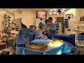 A day of thoracic surgery with professor tristan d yan