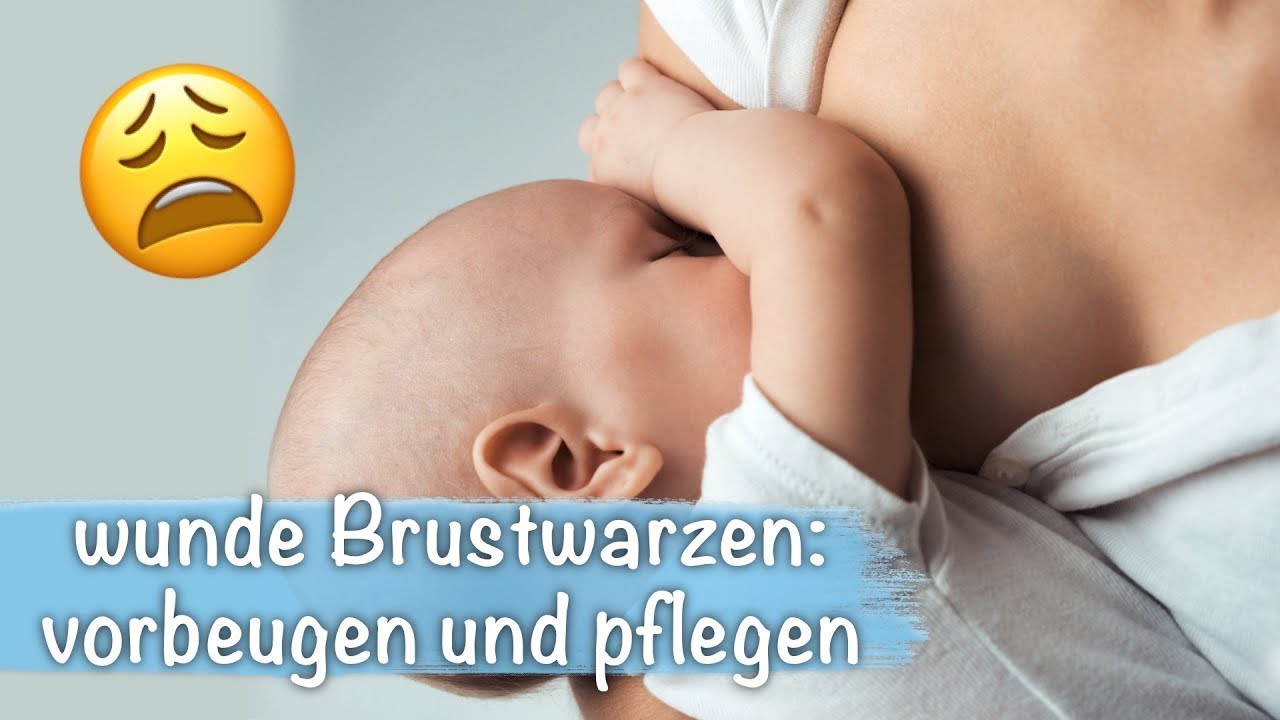 Stillen Brustwarzen schmerzen? YouTube