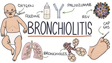 Understanding Bronchiolitis