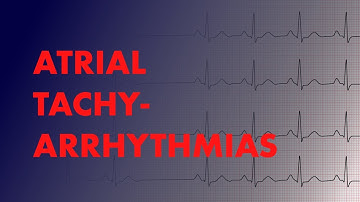 Atrial Arrhythmias (A-fib vs A-Flutter vs Focal vs Multifocal Atrial Tachycardia) - MEDZCOOL