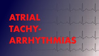 Atrial Arrhythmias A-Fib Vs A-Flutter Vs Focal Vs Multifocal Atrial Tachycardia - Medzcool
