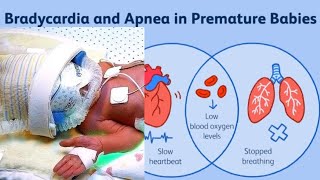 Newborn | Newborn Apnea | Premature Baby | Newborn Care | Pediatrics Apnea | नवजात को सांस में तकलीफ