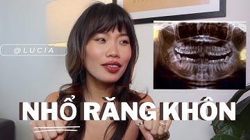 Nhổ răng khôn và những điều phải biết | Bắt đầu hành trình niềng răng | Lucia