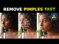 Remove Pimples &amp; Blemishes in DaVinci Resolve FREE | Skin Retouch Tutorial 🔥