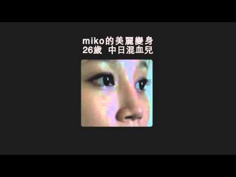 【熱河診所】高雄醫美 - Miko的美麗變身，晶亮瓷自然美鼻