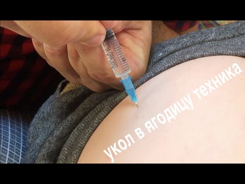 Укол в ягодицу техника. Как делать укол и не бояться сломать иглу! Укол внутримышечный в ягодицу