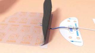 IV3000◊ IV Dressing 10x12cm 4008 application
