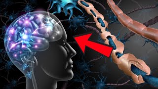 Dağınıq Skleroz Xəstəliyi Nədir?