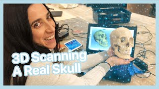 Scanning a Real Human Skull!
