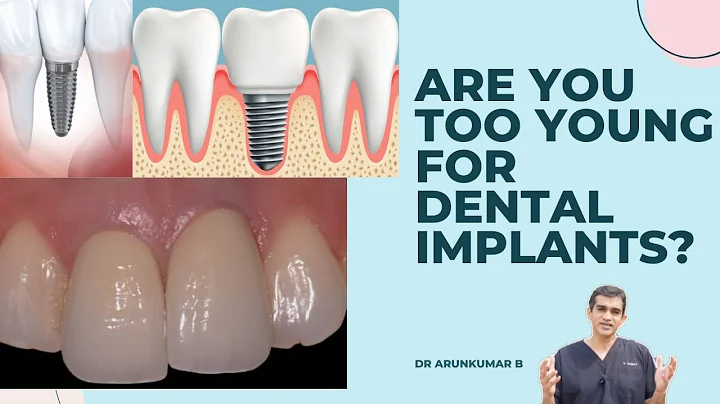Am I too young for Dental Implants? Right Age? Dr Arunkumar Pearls Dentistry | Dentist Chennai India