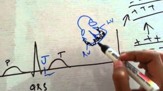 Information J Point ECG Discussion - Basics of Injury Potential Guide
