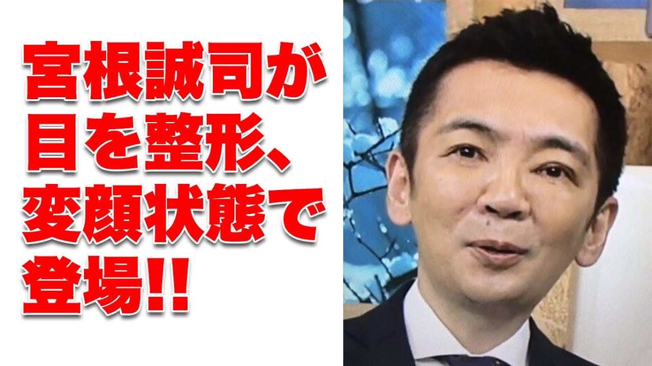宮根 整形