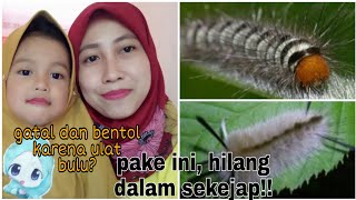CARA MENGHILANGKAN GATAL-GATAL dan BENTOL-BENTOL AKIBAT ULAT BULU DENGAN BAHAN ALAMI