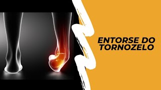 Entorse do tornozelo | pé | tibiotársica